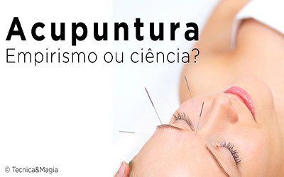 ACUPUNTURA