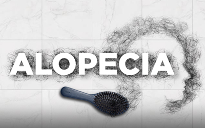 ALOPECIA