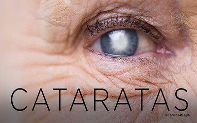 CATARATAS: QUANDO A VISÃO SE TORNA OPACA