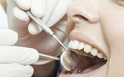 Cientistas criam material que pode regenerar esmalte dos dentes