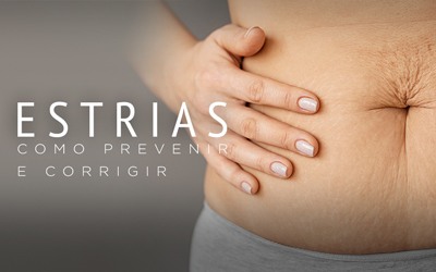 ESTRIAS, COMO PREVENIR E CORRIGIR