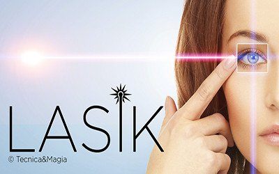 LASIK