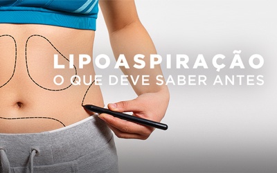 LIPOASPIRAÇÃO, O QUE DEVE SABER ANTES