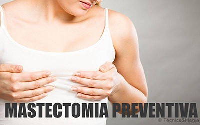 MASTECTOMIA PREVENTIVA