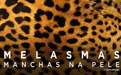 MELASMAS, MANCHAS DA PELE