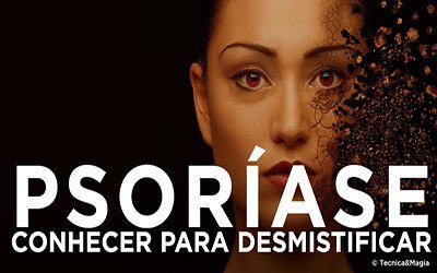 PSORÍASE CONHECER PARA DESMISTIFICAR