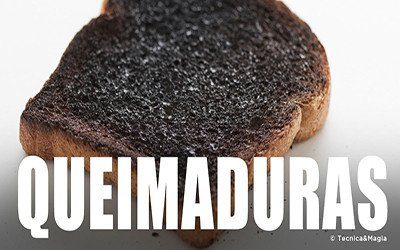 QUEIMADURAS