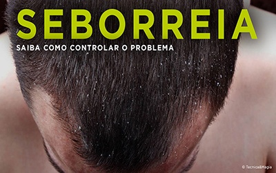 SEBORREIA - Saiba como controlar o problema!