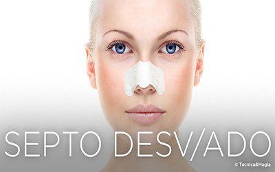 SEPTO NASAL DESVIADO