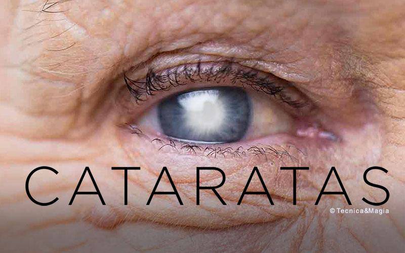 CATARATAS: QUANDO A VISÃO SE TORNA OPACA