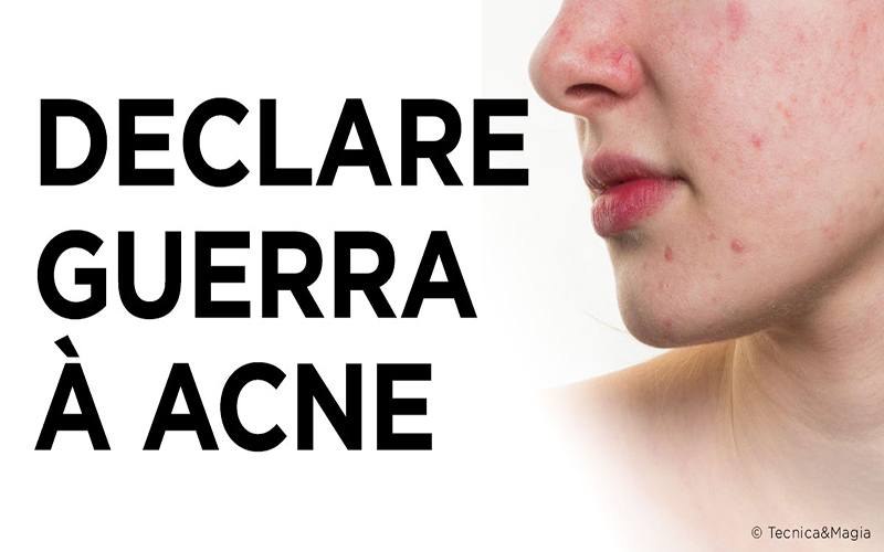 DECLARE GUERRA À ACNE