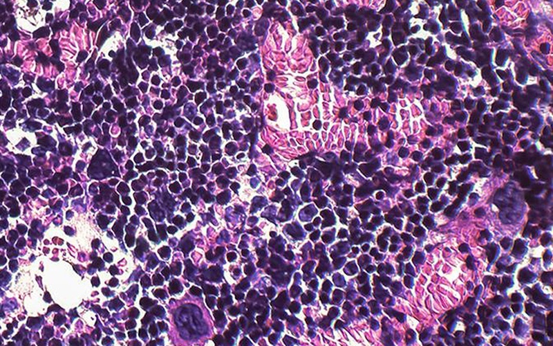 Estudo analisa impacto da obesidade nas células da medula óssea