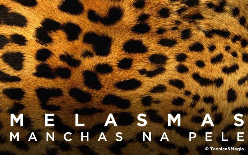 MELASMAS, MANCHAS DA PELE