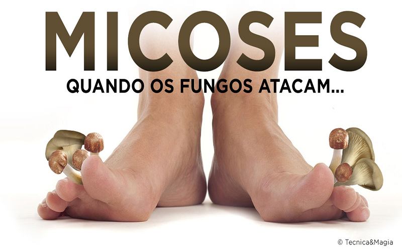 MICOSES - Quando os fungos atacam…