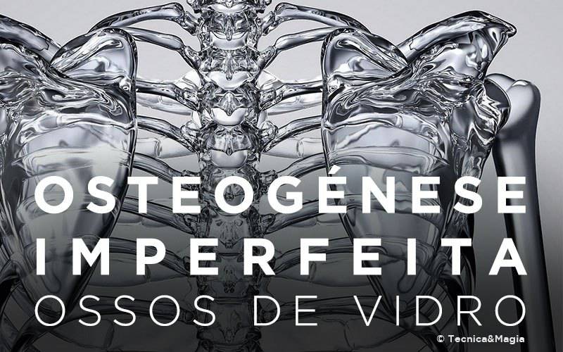 OSTEOGÉNESE IMPERFEITA OSSOS DE VIDRO