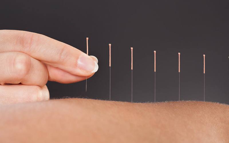 Primeira licenciatura certificada em acupunctura