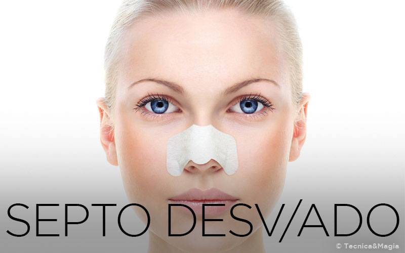 SEPTO NASAL DESVIADO