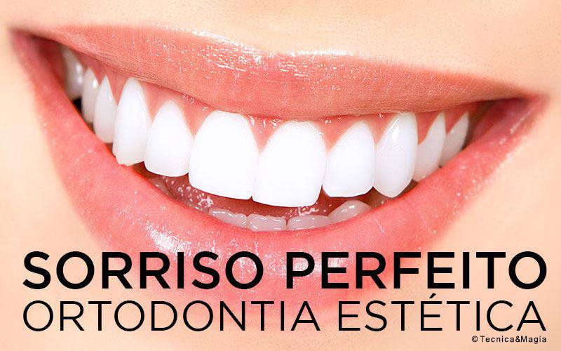 SORRISO PERFEITO, ORTODONTIA ESTÉTICA