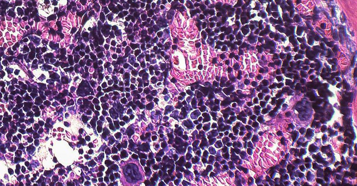 Estudo analisa impacto da obesidade nas células da medula óssea