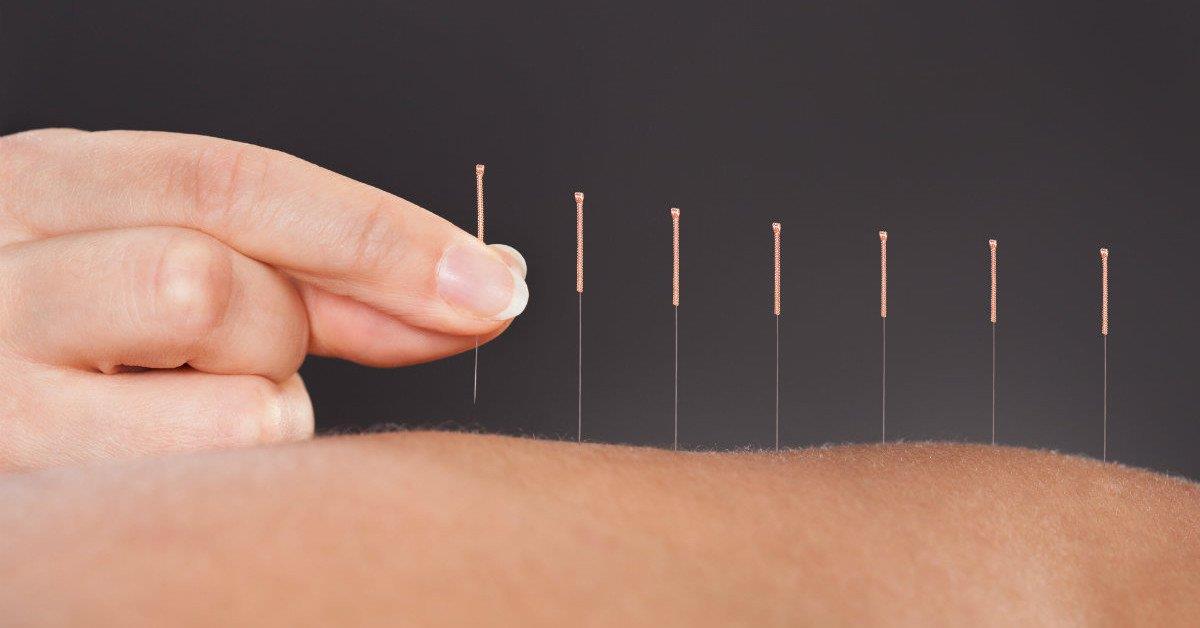 Primeira licenciatura certificada em acupunctura