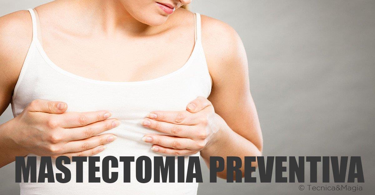 MASTECTOMIA PREVENTIVA