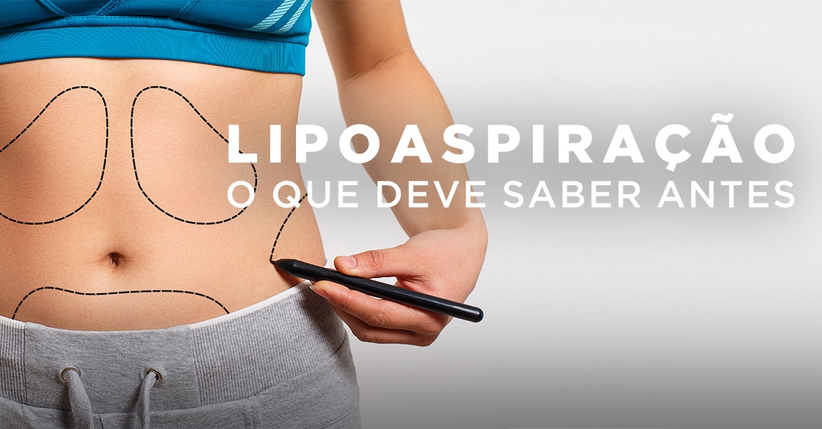 LIPOASPIRAÇÃO, O QUE DEVE SABER ANTES