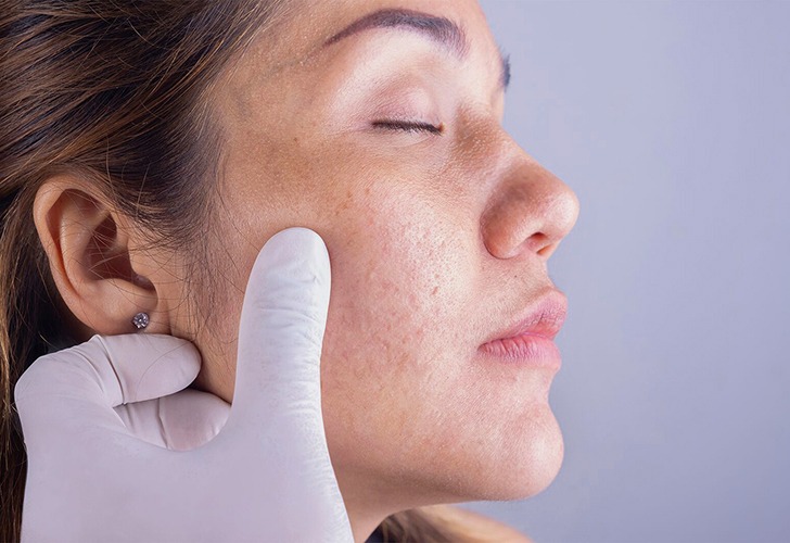 Consulta de dermatologia