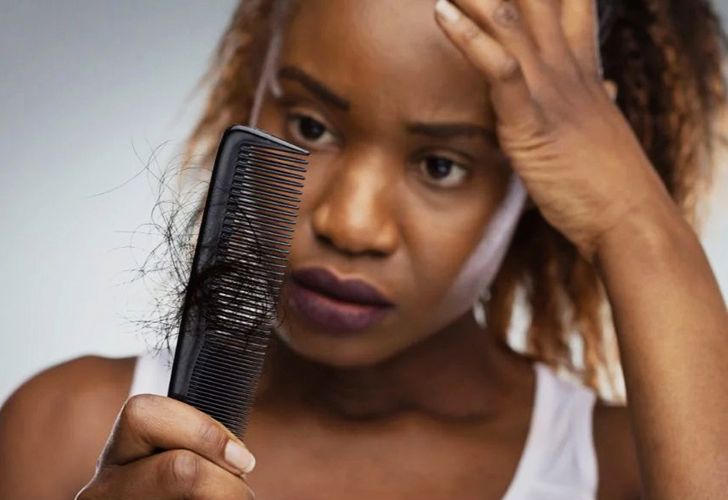 Mulher com queda de cabelo