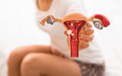 Mulheres com endometriose têm maior risco de ataque cardíaco